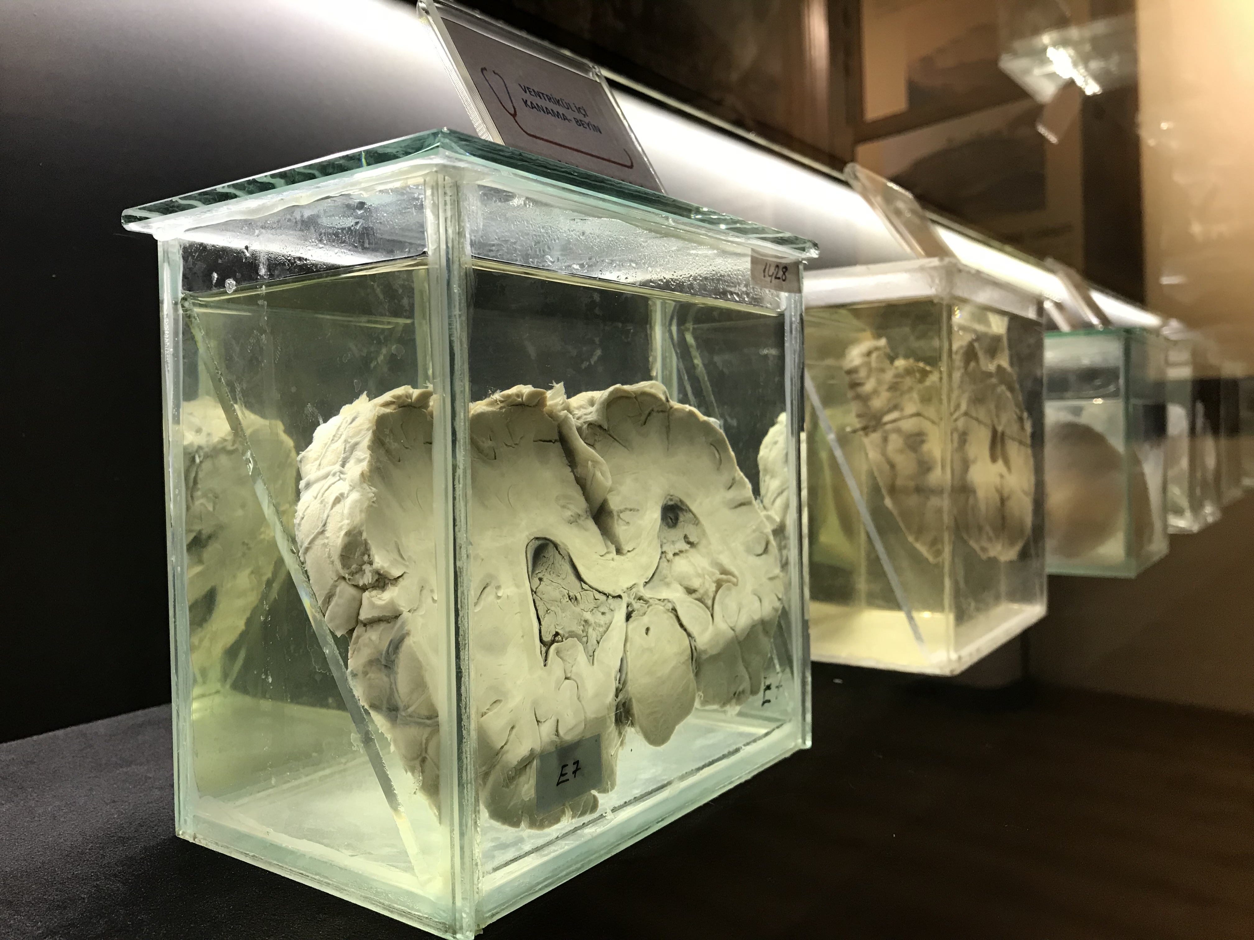 Nilüfer Belediyesi Dr. Ceyhun İrgil Sağlık Müzesi